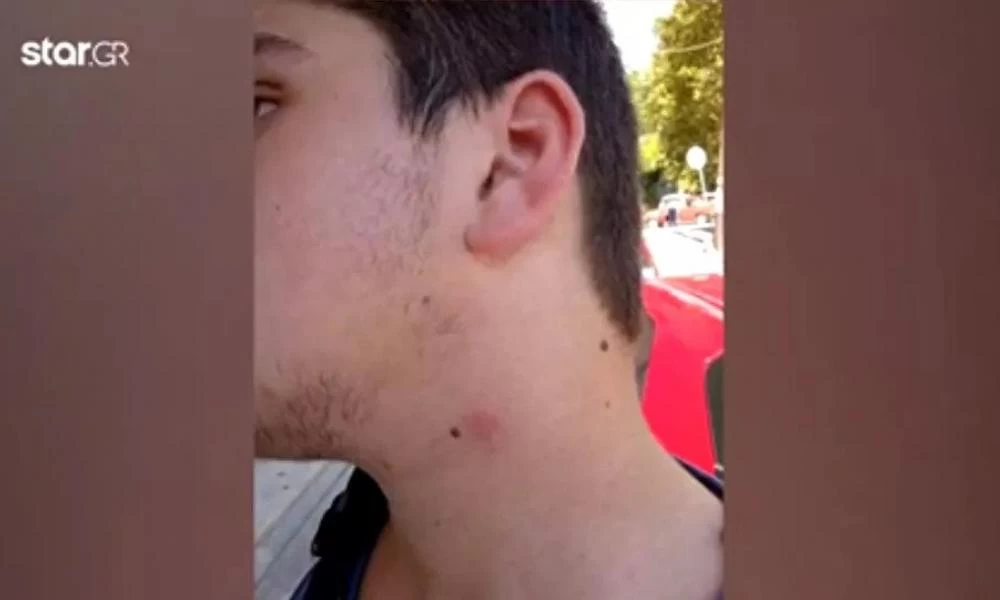 Μητέρα καταγγέλλει ξυλοδαρμό του γιου της σε κατάληψη: «Πήγαν να τον πνίξουν»